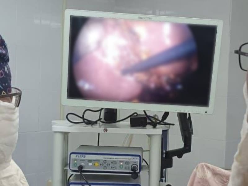 В Починковской районной больнице впервые удалили лапароскопическую холецистэктомию при помощи нового оборудования